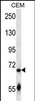 SLC27A3 Antibody in Western Blot (WB)