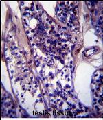 SPDL1 Antibody in Immunohistochemistry (Paraffin) (IHC (P))