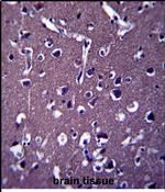 ZSWIM5 Antibody in Immunohistochemistry (Paraffin) (IHC (P))