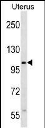 ZSWIM5 Antibody in Western Blot (WB)