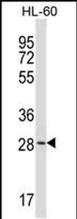 ZDHHC24 Antibody in Western Blot (WB)