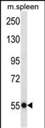 USP40 Antibody in Western Blot (WB)