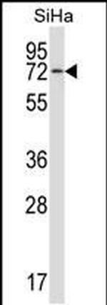HSPA12B Antibody in Western Blot (WB)