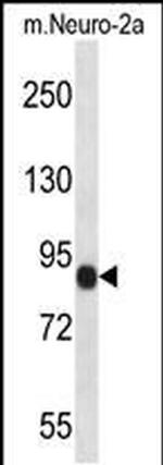 CHSY1 Antibody in Western Blot (WB)