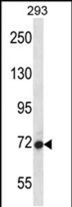 AGAP4 Antibody in Western Blot (WB)