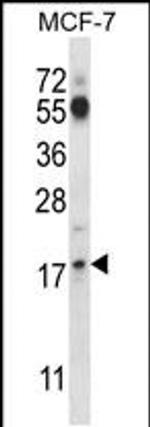 SSSCA1 Antibody in Western Blot (WB)