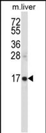 SSSCA1 Antibody in Western Blot (WB)