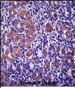 B4GALNT3 Antibody in Immunohistochemistry (Paraffin) (IHC (P))