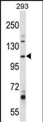 B4GALNT3 Antibody in Western Blot (WB)