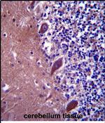 TTC13 Antibody in Immunohistochemistry (Paraffin) (IHC (P))