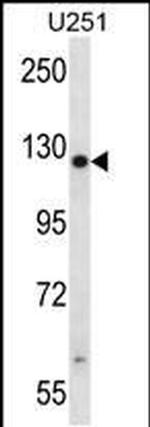 TTC13 Antibody in Western Blot (WB)