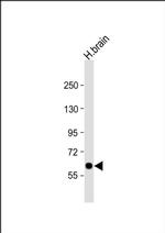 SLC2A13 Antibody in Western Blot (WB)