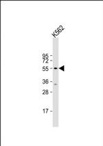 HYAL4 Antibody in Western Blot (WB)