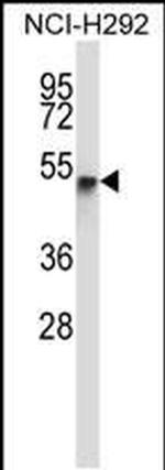 RANBP3L Antibody in Western Blot (WB)