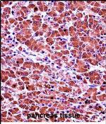 CELA3B Antibody in Immunohistochemistry (Paraffin) (IHC (P))