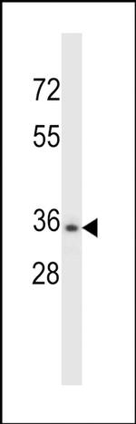 CELA3B Antibody in Western Blot (WB)