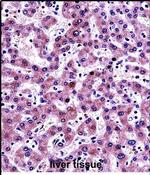 NNMT Antibody in Immunohistochemistry (Paraffin) (IHC (P))