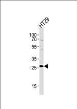 NNMT Antibody in Western Blot (WB)