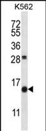 SCGB1D2 Antibody in Western Blot (WB)