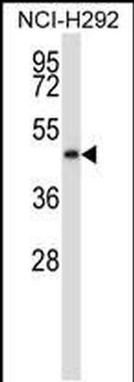 C5orf33 Antibody in Western Blot (WB)