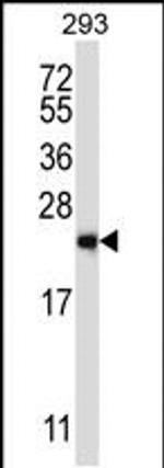 RAB1B Antibody in Western Blot (WB)
