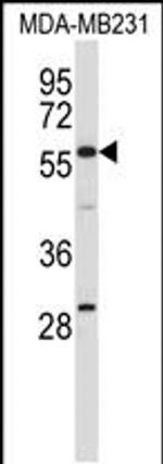 EHD1 Antibody in Western Blot (WB)