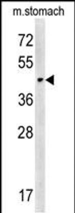 CHST14 Antibody in Western Blot (WB)