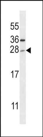 TICAM2 Antibody in Western Blot (WB)