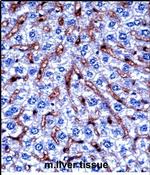 DYRK2 Antibody in Immunohistochemistry (Paraffin) (IHC (P))