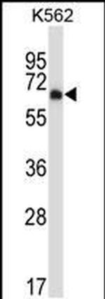DYRK2 Antibody in Western Blot (WB)