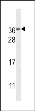 NMNAT3 Antibody in Western Blot (WB)