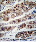 DDA1 Antibody in Immunohistochemistry (Paraffin) (IHC (P))
