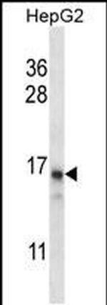 DDA1 Antibody in Western Blot (WB)