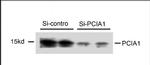 DDA1 Antibody in Western Blot (WB)