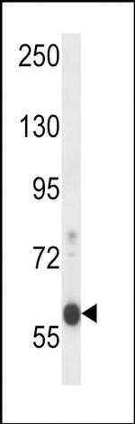 EFCAB7 Antibody in Western Blot (WB)