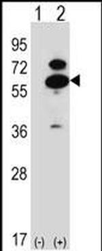 OXSR1 Antibody in Western Blot (WB)