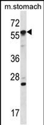 OXSR1 Antibody in Western Blot (WB)