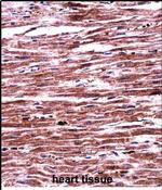 RNF19A Antibody in Immunohistochemistry (Paraffin) (IHC (P))
