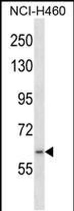 RNF19A Antibody in Western Blot (WB)