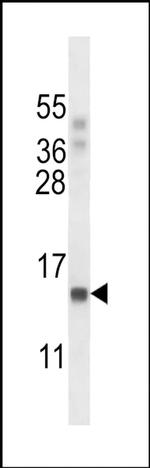 POLR2J Antibody in Western Blot (WB)