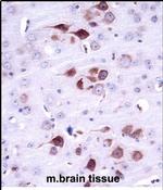 MATK Antibody in Immunohistochemistry (Paraffin) (IHC (P))