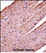 PDK3 Antibody in Immunohistochemistry (Paraffin) (IHC (P))