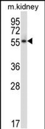 PLK5 Antibody in Western Blot (WB)