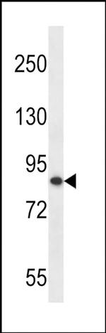 OTUD7B Antibody in Western Blot (WB)