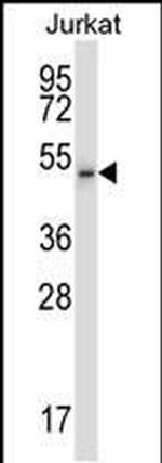 PFTK2 Antibody in Western Blot (WB)