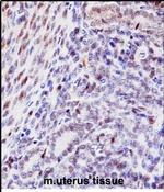 HOXD10 Antibody in Immunohistochemistry (Paraffin) (IHC (P))