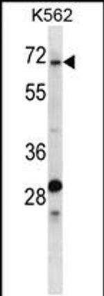 TRIP10 Antibody in Western Blot (WB)