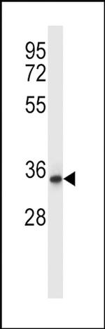 QPRT Antibody in Western Blot (WB)