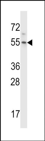 HM13 Antibody in Western Blot (WB)