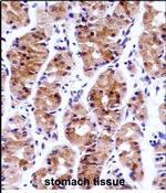 GTF2E1 Antibody in Immunohistochemistry (Paraffin) (IHC (P))
